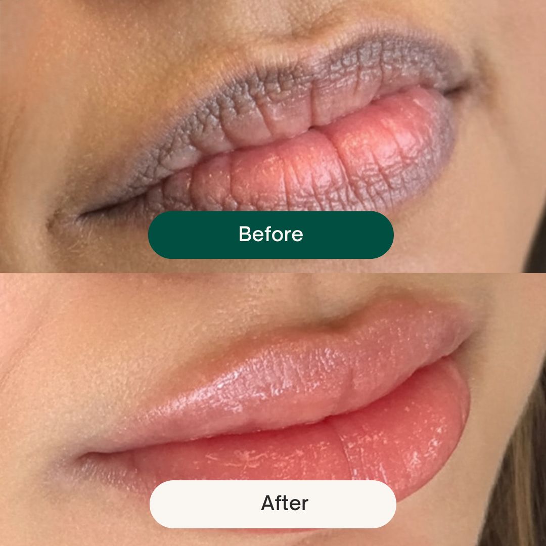 Before After 27
